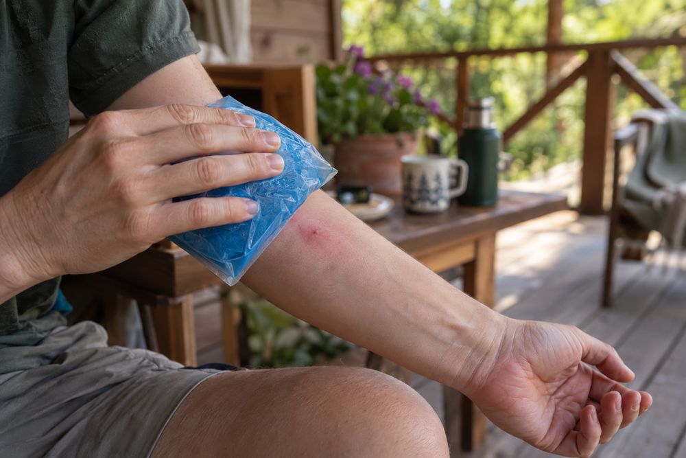 Forearm with a red sting mark against a summer porch